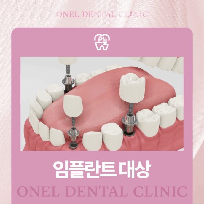 경산임플란트 식립을 고민 중이라면?
