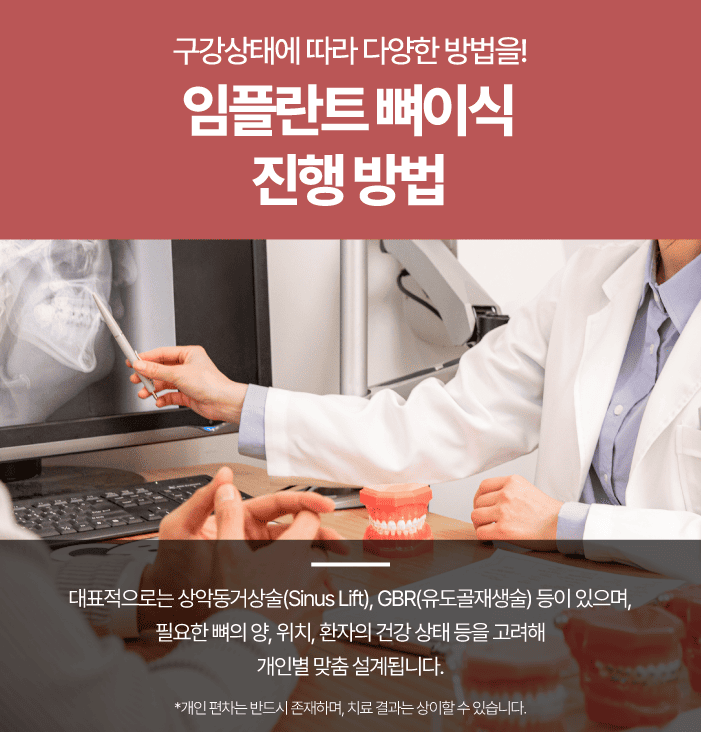 경산임플란트 식립 전 읽어볼 글